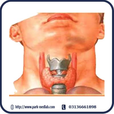 گره تیروئید چیست ؟