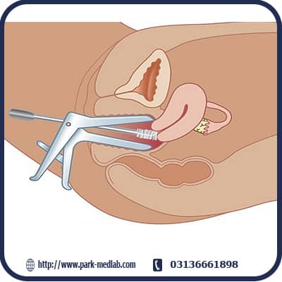 آزمایش پاپ اسمیر چیست ؟