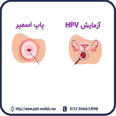 تشخیص ویروس HPV