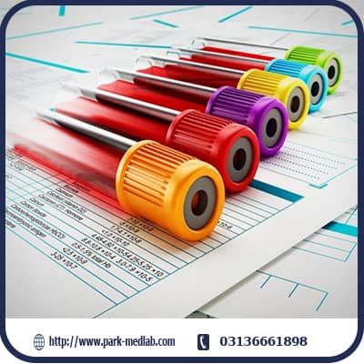 نحوه خواندن نتیجه آزمایش