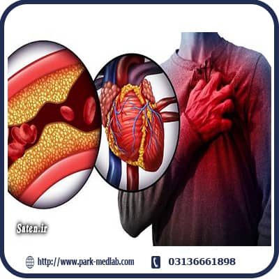 چگونگی بررسی کلسترول