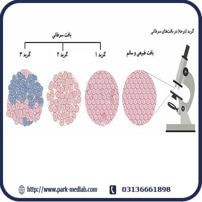 گزارش پاتولوژِی